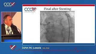 John M  Lasala  Atherectomy is a Must!