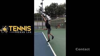 Utilizing the Entire Kinetic Chain to Increase Tennis Serve Speed while Protecting the Shoulder: 1