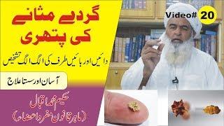 kidney stone ka Elaj ► Video 20 ► گردے کے مسائل  ► Hakeem Muhammad Iqbal Al Huda Guidance