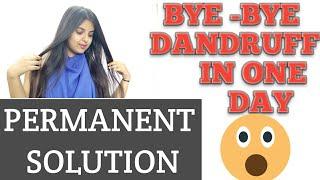 Dandruff removal at home || dandruff treatment in just 5 mins || get rid of dandruff in one day .