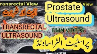 PROSTATE ULTRASOUND|#prostatesymptoms#BPH|#prostatitis |DR.MAHMOOD NADIM|URDU