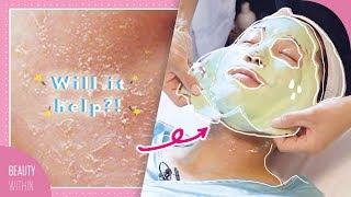 How to Prevent Milia + Dehydrated & Combination Skin Facial For ALL Skin Types'