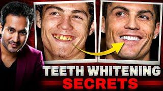 Celebrity TEETH WHITENING Secrets Revealed | Whiten 20 Shades in 1 Week