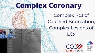 Complex PCI of Calcified Bifurcation, Complex Lesions of LCx - January 21, 2014 Webcast