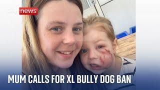 Mum tells how daughter was mauled by friend's American XL bully dog