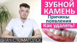 Зубной камень причины появления и как удалять. Как появляется зубные отложения из зубного налета.