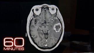 Frontotemporal Dementia | 60 Minutes Archive