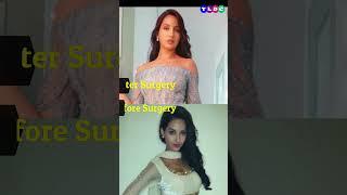 Top 5 Bollywood Actress Before & After Surgery  #bollywoodactresses #norafatehi #mouniroy #shorts