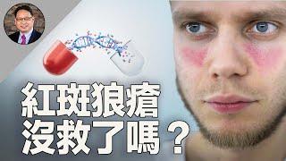 紅斑狼瘡=不死的癌症？揭秘誘發原因，分享自救指南！