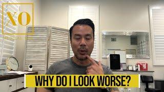 XO Medical Spa // Why do I look worse?