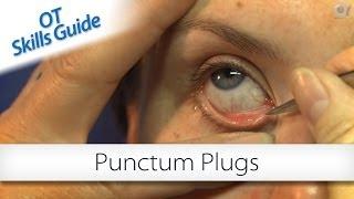OT skills guide: punctum plugs