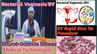 Rapid detection of Bacterial vaginosis (BV) test. Bacterial Vaginosis test procedure.
