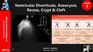 ACHD 7: Ventricular Diverticula, Aneurysm, Recess, Crypt & Cleft...