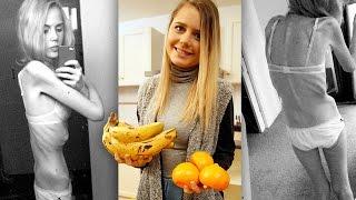 Hours From Death: Anorexia Sufferer’s Incredible Recovery