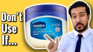 Vaseline on Face | Watch FIRST Before Using! 