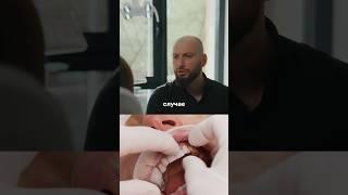 Виниры без ОБТОЧКИ, можно ли? Ответ в этом ролике! #cтоматология #виниры