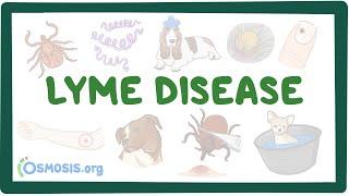 Lyme disease - causes, symptoms, diagnosis, treatment, pathology