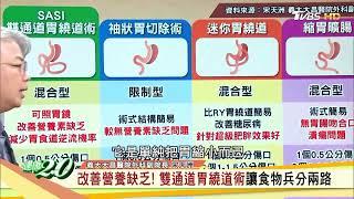 你是真胖子還是假胖子？讓食物兵分兩路，” SASI雙通道胃繞道術” 不易復胖且能改善營養缺乏！健康2.0