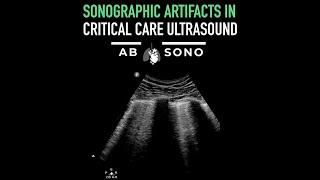 Alberta Sono presents: Sonographic artifacts in critical care ultrasound