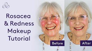 Rosacea & Redness Makeup Tutorial - Makeup for Older Women | Look Fabulous Forever