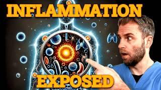 What Many People Don't Get About Inflammation