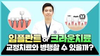 [신도림교정치과] 임플란트&크라운 치료 병행하고 싶다?!