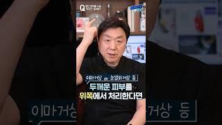 중년 쌍꺼풀 매몰법은 어렵다고? 절개로 하라고? 도대체 왜....?  #shorts