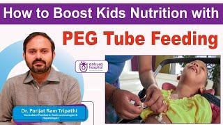 How to Improve Nutrition for Kids with PEG Tube Feeding || Essential Tips and Tricks || Ankura