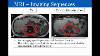 Introduction to Radiology: Magnetic Resonance Imaging