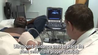 Stem Cell Therapy Using Fat Cells - Howard Beach, Ozone Park, Queens NY - Dr. Benjamin Bieber, MD
