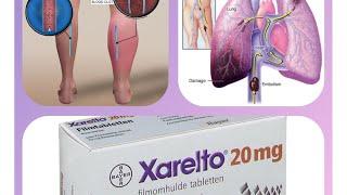 How to take Xarelto "rivaroxaban" ?