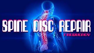 Spine Disc Repair Frequency