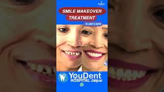 Best smile makeover treatment |Dr Rajesh Gupta YouDentJAIPUR  #bestcosmeticdentalclinic