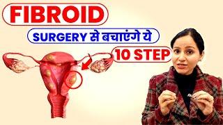 Fibroid Removal Without Surgery |  Fibroid Treatment Without Surgery | Ayurvedic Remedy For Fibroids