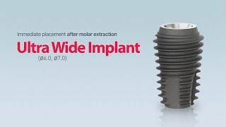 Ultra Wide-size Implant