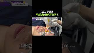 기미/주근깨 박살내는 레이저 TOP 1