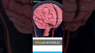 갑자기 정신을 잃고 쓰러지면? 미주신경성실신!