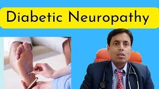 Diabetic Neuropathy // Peripheral Neuropathy // Dr Sanjay Chest Specialist and Diabetologist