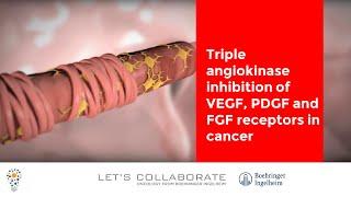 Triple angiokinase inhibition of VEGF, PDGF and FGF receptors in cancer