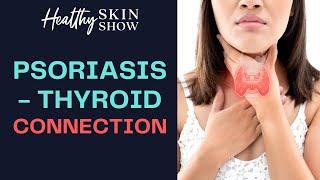 Psoriasis-Thyroid CONNECTION | Jennifer Fugo