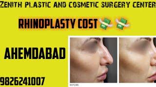 Rhinoplasty nose surgery cost in Ahemdabad Baroda Anand Rajkot Bhavnagar Navsari Bhuj Dahod