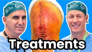 Infected Total Joint Replacement - How To Cure It