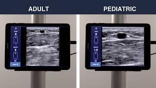 Getting to Know the EchoNous Vein. Pt 1