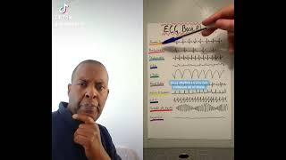 TEN  BASIC ECG RHYTHM & TREATMENTS