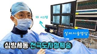심방세동 전극도자절제술 | 실제시술영상