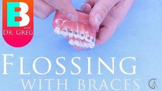 How to Floss with Braces (SuperFloss, Platypus, SoftPicks, etc)