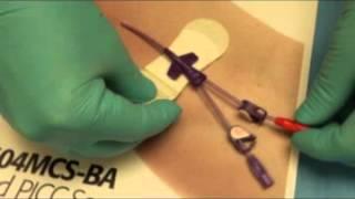 How to use Bard Grip-Lock PICC Catheter Hub Securement | Bard Catheter Securement Device