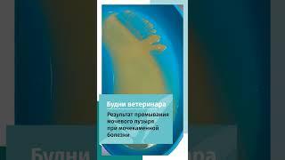 Осадок из мочевого пузыря