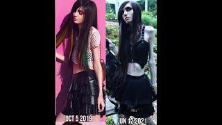 Eugenia Cooney's Arms The Past Two Weeks | May 30 to June 13, 2021 (YouTube, Twitch, Instagram)