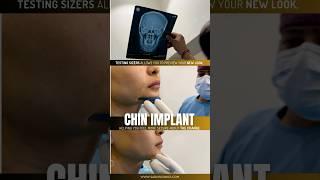 Chin Implant for a Sculpted Jawline | Dr. Adarsh Tripathi #beauty